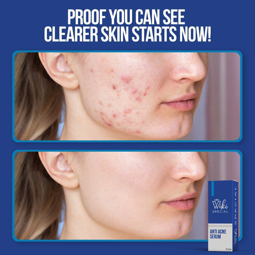 Wiki Special Serum